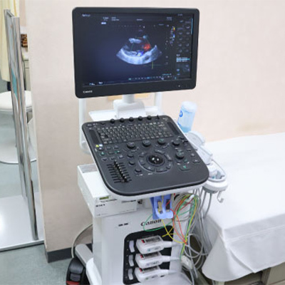 超音波画像診断装置